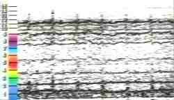 Bioenergy: Balanced Signature Field